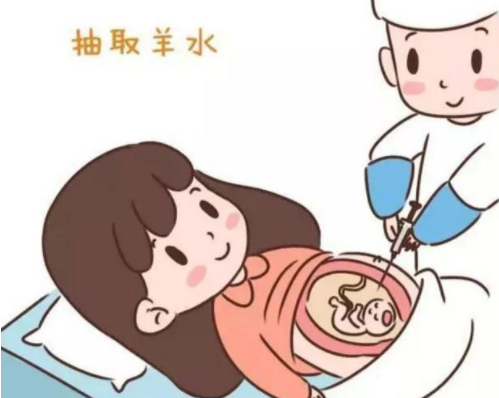 子宫肌瘤能羊水穿刺吗？